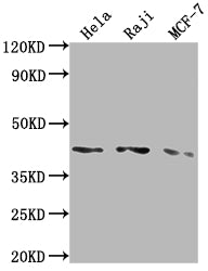 Western Blot; Positive WB detected in: Hela whole cell lysate, Raji whole cell lysate, MCF-7 whole cell lysate; All lanes: AGTR1 antibody at 1:2000; Secondary; Goat polyclonal to rabbit IgG at 1/50000 dilution; Predicted band size: 42 kDa; Observed band size: 42 kDa