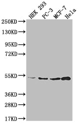 Western Blot; Positive WB detected in: HEK293 whole cell lysate, PC-3 whole cell lysate, MCF-7 whole cell lysate, Hela whole cell lysate; All lanes: AHCY antibody at 1:2000; Secondary; Goat polyclonal to rabbit IgG at 1/50000 dilution; Predicted band size: 48, 45 kDa; Observed band size: 36-55 kDa