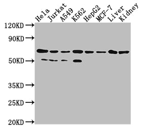 Western Blot; Positive WB detected in: Hela whole cell lysate, Jurkat whole cell lysate, A549 whole cell lysate, HepG2 whole cell lysate, MCF-7 whole cell lysate, Rat liver tissue, Rat kidney tissue; All lanes: AIFM1 antibody at 1:2000; Secondary; Goat polyclonal to rabbit IgG at 1/50000 dilution; Predicted band size: 67, 36, 29, 27 kDa; Observed band size: 67 kDa