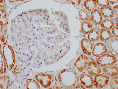 IHC image of RAC07133 diluted at 1:100 and staining in paraffin-embedded human kidney tissue performed on a Leica BondTM system. After dewaxing and hydration, antigen retrieval was mediated by high pressure in a citrate buffer (pH 6.0). Section was blocked with 10% normal goat serum 30min at RT. Then primary antibody (1% BSA) was incubated at 4? overnight. The primary is detected by a Goat anti-rabbit IgG polymer labeled by HRP and visualized using 0.05% DAB.
