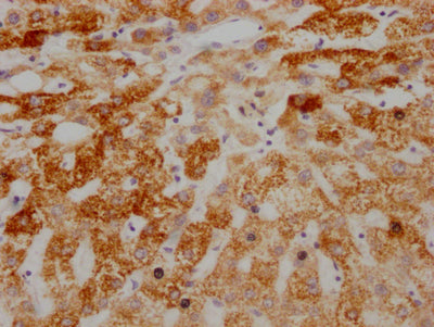 IHC image of RAC07133 diluted at 1:100 and staining in paraffin-embedded human liver tissue performed on a Leica BondTM system. After dewaxing and hydration, antigen retrieval was mediated by high pressure in a citrate buffer (pH 6.0). Section was blocked with 10% normal goat serum 30min at RT. Then primary antibody (1% BSA) was incubated at 4? overnight. The primary is detected by a Goat anti-rabbit IgG polymer labeled by HRP and visualized using 0.05% DAB.