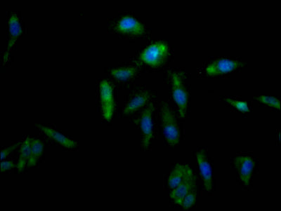 Immunofluorescence staining of Hela Cells with RAC07134 at 1:50, counter-stained with DAPI. The cells were fixed in 4% formaldehyde, permeated by 0.2% TritonX-100, and blocked in 10% normal Goat Serum. The cells were then incubated with the antibody overnight at 4?. Nuclear DNA was labeled in blue with DAPI. The secondary antibody was FITC-conjugated AffiniPure Goat Anti-Rabbit IgG (H+L).