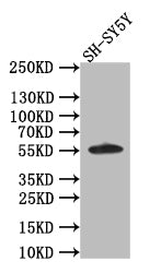 Western Blot; Positive WB detected in: SH-SY5Y whole cell lysate; All lanes: CD44 antibody at 1:1000; Secondary; Goat polyclonal to rabbit IgG at 1/50000 dilution; Predicted band size: 56 kDa; Observed band size: 56 kDa