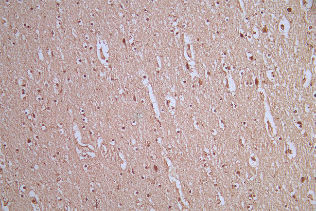 IHC image of RAC07135 diluted at 1:50 and staining in paraffin-embedded human brain tissue performed on a Leica BondTM system. After dewaxing and hydration, antigen retrieval was mediated by high pressure in a citrate buffer (pH 6.0). Section was blocked with 10% normal goat serum 30min at RT. Then primary antibody (1% BSA) was incubated at 4Â°C overnight. The primary is detected by a Goat anti-rabbit polymer IgG labeled by HRP and visualized using 0.54% DAB.