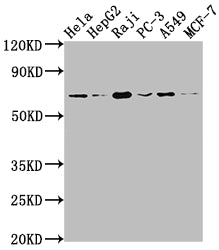 Western Blot; Positive WB detected in: Hela whole cell lysate, HepG2 whole cell lysate, Raji whole cell lysate, PC-3 whole cell lysate, A549 whole cell lysate, MCF-7 whole cell lysate; All lanes: ALAS1 antibody at 1:1500; Secondary; Goat polyclonal to rabbit IgG at 1/50000 dilution; Predicted band size: 71, 13 kDa; Observed band size: 71 kDa