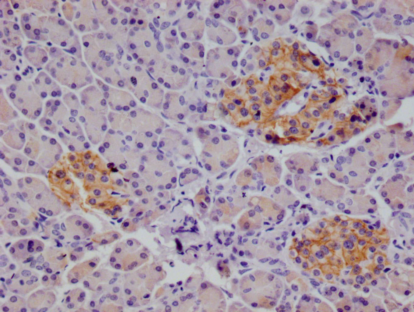 IHC image of RAC07138 diluted at 1:100 and staining in paraffin-embedded human pancreatic tissue performed on a Leica BondTM system. After dewaxing and hydration, antigen retrieval was mediated by high pressure in a citrate buffer (pH 6.0). Section was blocked with 10% normal goat serum 30min at RT. Then primary antibody (1% BSA) was incubated at 4Â°C overnight. The primary is detected by a Goat anti-rabbit polymer IgG labeled by HRP and visualized using 0.05% DAB.