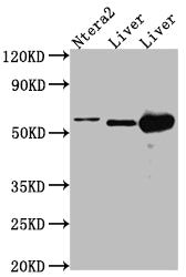 Western Blot; Positive WB detected in: Ntera-2 whole cell lysate, Mouse Liver whole cell lysate, Rat Liver cell lysate; All lanes: ALDH2 antibody at 1:1000; Secondary; Goat polyclonal to rabbit IgG at 1/50000 dilution; Predicted band size: 57, 51 kDa; Observed band size: 57 kDa