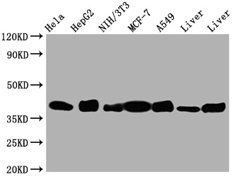 Western Blot; Positive WB detected in: Hela whole cell lysate, HepG2 whole cell lysate, NIH/3T3 whole cell lysate, A549 whole cell lysate, Mouse Liver whole cell lysate, Rat Liver whole cell lysate; All lanes: Aldolase antibody at 1:1000; Secondary; Goat polyclonal to rabbit IgG at 1/50000 dilution; Predicted band size: 40, 46 kDa; Observed band size: 40 kDa