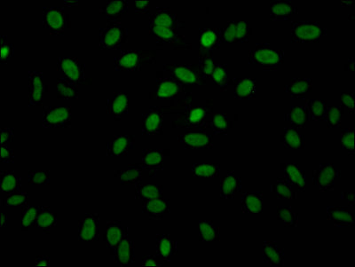 Immunofluorescence staining of Hela Cells with RAC07140 at 1:50, counter-stained with DAPI. The cells were fixed in 4% formaldehyde, permeated by 0.2% TritonX-100, and blocked in 10% normal Goat Serum. The cells were then incubated with the antibody overnight at 4?. Nuclear DNA was labeled in blue with DAPI. The secondary antibody was FITC-conjugated AffiniPure Goat Anti-Rabbit IgG (H+L).