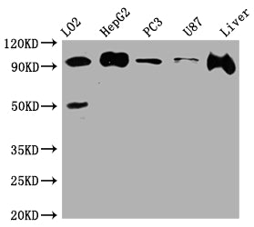Western Blot; Positive WB detected in: L02 whole cell lysate, HepG2 whole cell lysate, PC-3 whole cell lysate, U-87 whole cell lysate, Rat Liver whole cell lysate; All lanes: ALIX antibody at 1:1000; Secondary; Goat polyclonal to rabbit IgG at 1/50000 dilution; Predicted band size: 97, 97, 31 kDa; Observed band size: 97 kDa