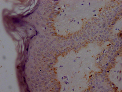 IHC image of RAC07142 diluted at 1:100 and staining in paraffin-embedded human skin tissue performed on a Leica BondTM system. After dewaxing and hydration, antigen retrieval was mediated by high pressure in a citrate buffer (pH 6.0). Section was blocked with 10% normal goat serum 30min at RT. Then primary antibody (1% BSA) was incubated at 4? overnight. The primary is detected by a Goat anti-rabbit IgG polymer labeled by HRP and visualized using 0.05% DAB.