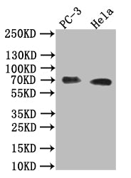Western Blot; Positive WB detected in: PC-3 whole cell lysate,Hela whole cell lysate; All lanes: Placental alkaline phosphatase (PLAP) antibody at 1:1000; Secondary; Goat polyclonal to rabbit IgG at 1/50000 dilution; Predicted band size: 70 kDa; Observed band size: 70 kDa