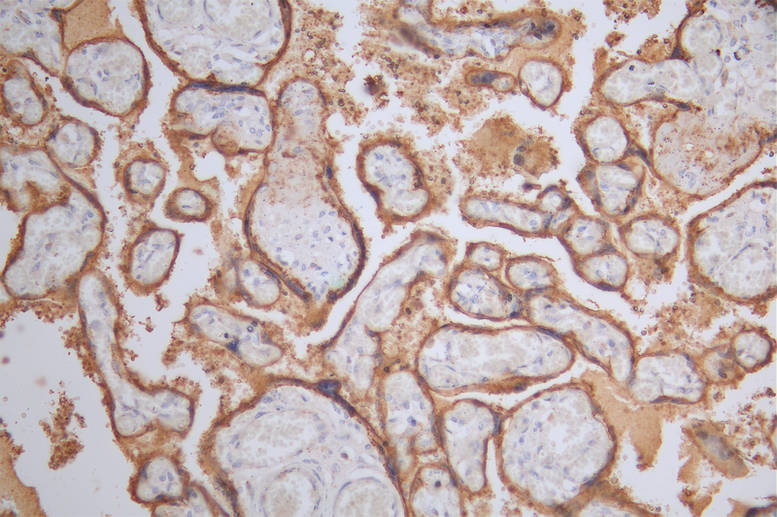 IHC image of RAC07143 diluted at 1:50 and staining in paraffin-embedded human placenta tissue performed on a Leica BondTM system. After dewaxing and hydration, antigen retrieval was mediated by high pressure in a citrate buffer (pH 6.0). Section was blocked with 10% normal goat serum 30min at RT. Then primary antibody (1% BSA) was incubated at 4Â°C overnight. The primary is detected by a Goat anti-rabbit polymer IgG labeled by HRP and visualized using 0.39% DAB.