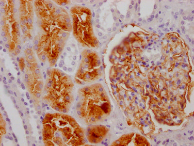 IHC image of RAC07144 diluted at 1:100 and staining in paraffin-embedded human kidney tissue performed on a Leica BondTM system. After dewaxing and hydration, antigen retrieval was mediated by high pressure in a citrate buffer (pH 6.0). Section was blocked with 10% normal goat serum 30min at RT. Then primary antibody (1% BSA) was incubated at 4? overnight. The primary is detected by a Goat anti-rabbit IgG polymer labeled by HRP and visualized using 0.05% DAB.