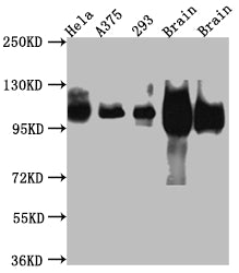 Western Blot; Positive WB detected in: Hela whole cell lysate, A375 whole cell lysate, HEK293 whole cell lysate, Rat Brain whole cell lysate, Mouse Brain whole cell lysate; All lanes: Amyloid beta A4 antibody at 1:1000; Secondary; Goat polyclonal to rabbit IgG at 1/50000 dilution; Predicted band size: 87, 35, 77, 79, 79, 81, 83, 85, 86, 73, 85 kDa; Observed band size: 100 kDa