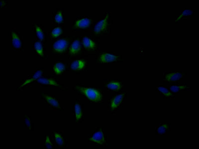 Immunofluorescence staining of Hela Cells with RAC07145 at 1:50, counter-stained with DAPI. The cells were fixed in 4% formaldehyde, permeated by 0.2% TritonX-100, and blocked in 10% normal Goat Serum. The cells were then incubated with the antibody overnight at 4?. Nuclear DNA was labeled in blue with DAPI. The secondary antibody was FITC-conjugated AffiniPure Goat Anti-Rabbit IgG (H+L).
