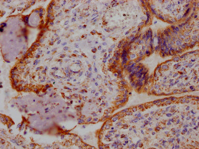 IHC image of RAC07147 diluted at 1:100 and staining in paraffin-embedded human placenta tissue performed on a Leica BondTM system. After dewaxing and hydration, antigen retrieval was mediated by high pressure in a citrate buffer (pH 6.0). Section was blocked with 10% normal goat serum 30min at RT. Then primary antibody (1% BSA) was incubated at 4? overnight. The primary is detected by a Goat anti-rabbit IgG polymer labeled by HRP and visualized using 0.05% DAB.