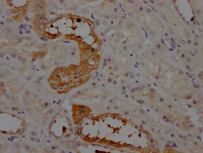 IHC image of RAC07148 diluted at 1:100 and staining in paraffin-embedded human kidney tissue performed on a Leica BondTM system. After dewaxing and hydration, antigen retrieval was mediated by high pressure in a citrate buffer (pH 6.0). Section was blocked with 10% normal goat serum 30min at RT. Then primary antibody (1% BSA) was incubated at 4? overnight. The primary is detected by a Goat anti-rabbit IgG polymer labeled by HRP and visualized using 0.05% DAB.