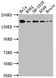 Western Blot; Positive WB detected in: Hela whole cell lysate, K562 whole cell lysate, SH-SY5Y whole cell lysate, A549 whole cell lysate, Rat Brain whole cell lysate; All lanes: APC antibody at 1:1000; Secondary; Goat polyclonal to rabbit IgG at 1/50000 dilution; Predicted band size: 312, 301, 309 kDa; Observed band size: 160 kDa