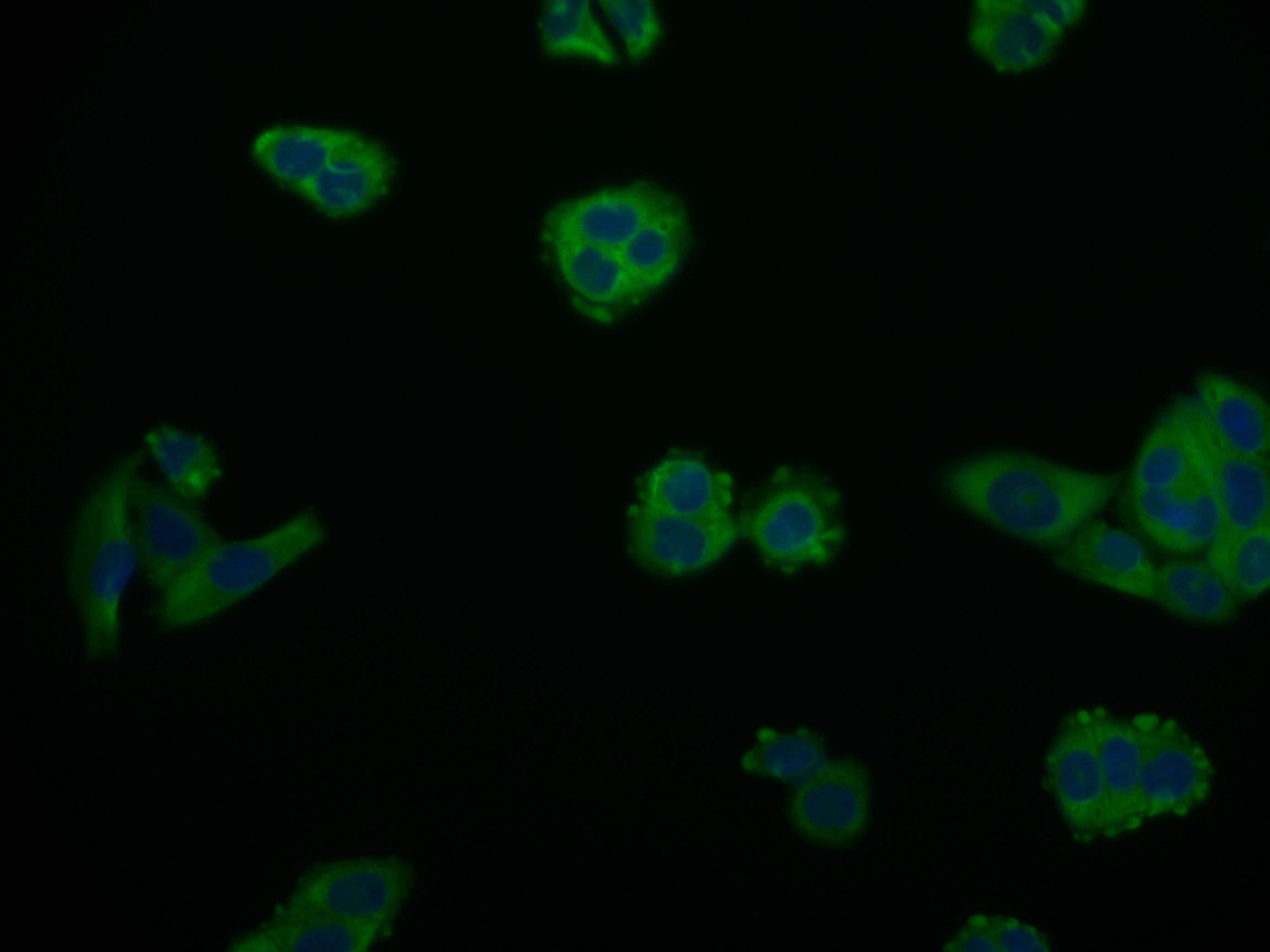 Immunofluorescence staining of PC-3 cell with RAC07155 at 1:50, counter-stained with DAPI. The cells were fixed in 4% formaldehyde and blocked in 10% normal Goat Serum. The cells were then incubated with the antibody overnight at 4Â°C. The secondary antibody was Alexa Fluor 559-congugated AffiniPure Goat Anti-Rabbit IgG(H+L).
