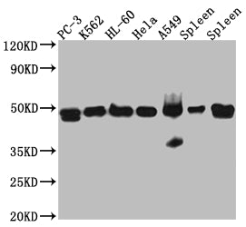 Western Blot; Positive WB detected in: PC-3 whole cell lysate, K562 whole cell lysate, HL-60 whole cell lysate, A549 whole cell lysate, Mouse Spleen whole cell lysate, Rat Spleen whole cell lysate; All lanes: Arp3 Antibody at 1:1000; Secondary; Goat polyclonal to rabbit IgG at 1/50000 dilution; Predicted band size: 48 kDa; Observed band size: 48 kDa