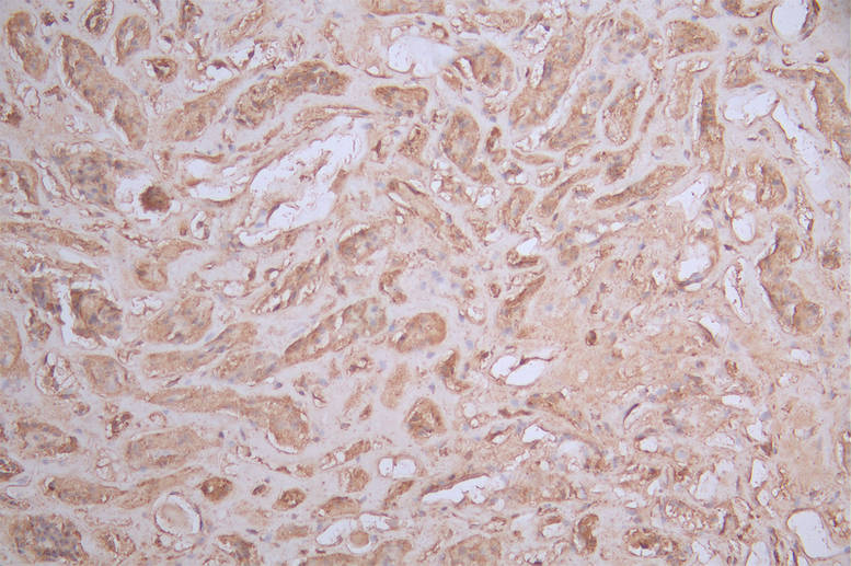 IHC image of RAC07158 diluted at 1:100 and staining in paraffin-embedded human kidney tissue performed on a Leica BondTM system. After dewaxing and hydration, antigen retrieval was mediated by high pressure in a citrate buffer (pH 6.0). Section was blocked with 10% normal goat serum 30min at RT. Then primary antibody (1% BSA) was incubated at 4Â°C overnight. The primary is detected by a Goat anti-rabbit polymer IgG labeled by HRP and visualized using 0.56% DAB.