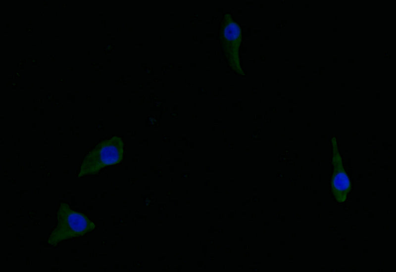 Immunofluorescence staining of Hela with RAC07158 at 1:50, counter-stained with DAPI. The cells were fixed in 4% formaldehyde and blocked in 10% normal Goat Serum. The cells were then incubated with the antibody overnight at 4Â°C. The secondary antibody was Alexa Fluor 516-congugated AffiniPure Goat Anti-Rabbit IgG(H+L).