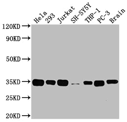 Western Blot; Positive WB detected in: Hela whole cell lysate, 293 whole cell lysate, Jurkat whole cell lysate, SH-SY5Y whole cell lysate, THP-1 whole cell lysate, PC-3 whole cell lysate, Rat brain tissue; All lanes: ATF5 antibody at 1:2000; Secondary; Goat polyclonal to rabbit IgG at 1/50000 dilution; Predicted band size: 31 kDa; Observed band size: 35 kDa