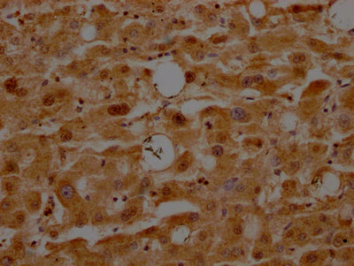 IHC image of RAC07160 diluted at 1:100 and staining in paraffin-embedded human liver tissue performed on a Leica BondTM system. After dewaxing and hydration, antigen retrieval was mediated by high pressure in a citrate buffer (pH 6.0). Section was blocked with 10% normal goat serum 30min at RT. Then primary antibody (1% BSA) was incubated at 4? overnight. The primary is detected by a Goat anti-rabbit IgG polymer labeled by HRP and visualized using 0.05% DAB.