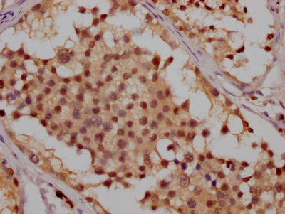 IHC image of RAC07162 diluted at 1:100 and staining in paraffin-embedded human testis tissue performed on a Leica BondTM system. After dewaxing and hydration, antigen retrieval was mediated by high pressure in a citrate buffer (pH 6.0). Section was blocked with 10% normal goat serum 30min at RT. Then primary antibody (1% BSA) was incubated at 4? overnight. The primary is detected by a Goat anti-rabbit IgG polymer labeled by HRP and visualized using 0.05% DAB.