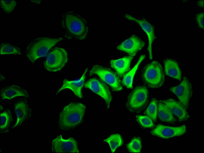 Immunofluorescence staining of HepG2 Cells with RAC07163 at 1:50, counter-stained with DAPI. The cells were fixed in 4% formaldehyde, permeated by 0.2% TritonX-100, and blocked in 10% normal Goat Serum. The cells were then incubated with the antibody overnight at 4?. Nuclear DNA was labeled in blue with DAPI. The secondary antibody was FITC-conjugated AffiniPure Goat Anti-Rabbit IgG (H+L).