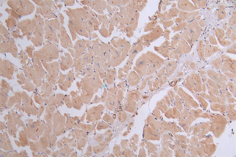 IHC image of RAC07164 diluted at 1:50 and staining in paraffin-embedded human heart tissue performed on a Leica BondTM system. After dewaxing and hydration, antigen retrieval was mediated by high pressure in a citrate buffer (pH 6.0). Section was blocked with 10% normal goat serum 30min at RT. Then primary antibody (1% BSA) was incubated at 4Â°C overnight. The primary is detected by a Goat anti-rabbit polymer IgG labeled by HRP and visualized using 0.41% DAB.