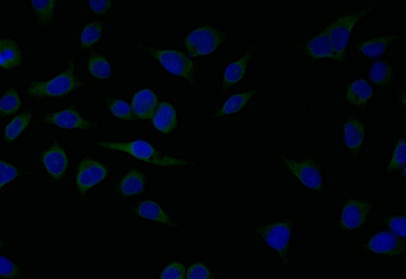 Immunofluorescence staining of MCF7 with RAC07164 at 1:25, counter-stained with DAPI. The cells were fixed in 4% formaldehyde and blocked in 10% normal Goat Serum. The cells were then incubated with the antibody overnight at 4Â°C. The secondary antibody was Alexa Fluor 509-congugated AffiniPure Goat Anti-Rabbit IgG(H+L).