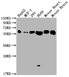 Western Blot; Positive WB detected in: HepG2 whole cell lysate, MCF-7 whole cell lysate, 293 whole cell lysate, HL60 whole cell lysate, Mouse Heart tissue, Mouse Brain tissue; All lanes: ATP5F1A antibody at 1:2000; Secondary; Goat polyclonal to rabbit IgG at 1/50000 dilution; Predicted band size: 60, 55, 58 kDa; Observed band size: 60 kDa