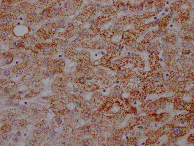 IHC image of RAC07165 diluted at 1:100 and staining in paraffin-embedded human liver tissue performed on a Leica BondTM system. After dewaxing and hydration, antigen retrieval was mediated by high pressure in a citrate buffer (pH 6.0). Section was blocked with 10% normal goat serum 30min at RT. Then primary antibody (1% BSA) was incubated at 4? overnight. The primary is detected by a Goat anti-rabbit IgG polymer labeled by HRP and visualized using 0.05% DAB.
