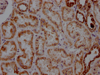 IHC image of RAC07165 diluted at 1:100 and staining in paraffin-embedded human kidney tissue performed on a Leica BondTM system. After dewaxing and hydration, antigen retrieval was mediated by high pressure in a citrate buffer (pH 6.0). Section was blocked with 10% normal goat serum 30min at RT. Then primary antibody (1% BSA) was incubated at 4? overnight. The primary is detected by a Goat anti-rabbit IgG polymer labeled by HRP and visualized using 0.05% DAB.