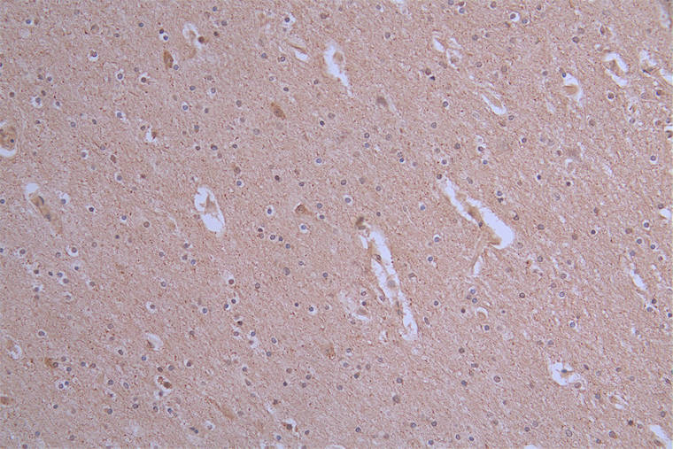 IHC image of RAC07166 diluted at 1:50 and staining in paraffin-embedded human brain tissue performed on a Leica BondTM system. After dewaxing and hydration, antigen retrieval was mediated by high pressure in a citrate buffer (pH 6.0). Section was blocked with 10% normal goat serum 30min at RT. Then primary antibody (1% BSA) was incubated at 4Â°C overnight. The primary is detected by a Goat anti-rabbit polymer IgG labeled by HRP and visualized using 0.19% DAB.