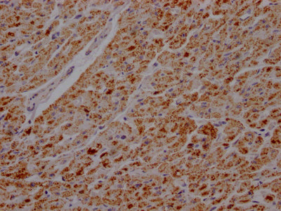 IHC image of RAC07167 diluted at 1:100 and staining in paraffin-embedded human heart tissue performed on a Leica BondTM system. After dewaxing and hydration, antigen retrieval was mediated by high pressure in a citrate buffer (pH 6.0). Section was blocked with 10% normal goat serum 30min at RT. Then primary antibody (1% BSA) was incubated at 4? overnight. The primary is detected by a Goat anti-rabbit IgG polymer labeled by HRP and visualized using 0.05% DAB.