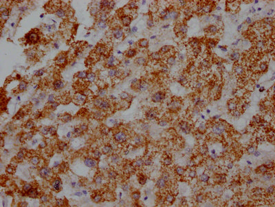 IHC image of RAC07167 diluted at 1:100 and staining in paraffin-embedded human liver tissue performed on a Leica BondTM system. After dewaxing and hydration, antigen retrieval was mediated by high pressure in a citrate buffer (pH 6.0). Section was blocked with 10% normal goat serum 30min at RT. Then primary antibody (1% BSA) was incubated at 4? overnight. The primary is detected by a Goat anti-rabbit IgG polymer labeled by HRP and visualized using 0.05% DAB.