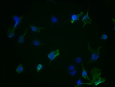 Immunofluorescence staining of Hela Cells with RAC07168 at 1:50, counter-stained with DAPI. The cells were fixed in 4% formaldehyde, permeated by 0.2% TritonX-100, and blocked in 10% normal Goat Serum. The cells were then incubated with the antibody overnight at 4?. Nuclear DNA was labeled in blue with DAPI. The secondary antibody was FITC-conjugated AffiniPure Goat Anti-Rabbit IgG (H+L).