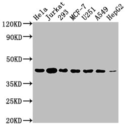 Western Blot; Positive WB detected in: Hela whole cell lysate, Jurkat whole cell lysate, 293 whole cell lysate, MCF-7 whole cell lysate, U251 whole cell lysate, A549 whole cell lysate, HepG2 whole cell lysate; All lanes: AURKB antibody at 1:2000; Secondary; Goat polyclonal to rabbit IgG at 1/50000 dilution; Predicted band size: 40, 36, 17, 35 kDa; Observed band size: 40 kDa