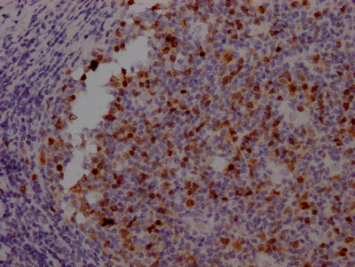 IHC image of RAC07169 diluted at 1:100 and staining in paraffin-embedded human tonsil tissue performed on a Leica BondTM system. After dewaxing and hydration, antigen retrieval was mediated by high pressure in a citrate buffer (pH 6.0). Section was blocked with 10% normal goat serum 30min at RT. Then primary antibody (1% BSA) was incubated at 4? overnight. The primary is detected by a Goat anti-rabbit IgG polymer labeled by HRP and visualized using 0.05% DAB.