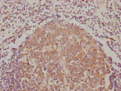 IHC image of RAC07174 diluted at 1:90 and staining in paraffin-embedded human lymph node tissue performed on a Leica BondTM system. After dewaxing and hydration, antigen retrieval was mediated by high pressure in a citrate buffer (pH 6.0). Section was blocked with 10% normal goat serum 30min at RT. Then primary antibody (1% BSA) was incubated at 4? overnight. The primary is detected by a biotinylated secondary antibody and visualized using an HRP conjugated SP system.