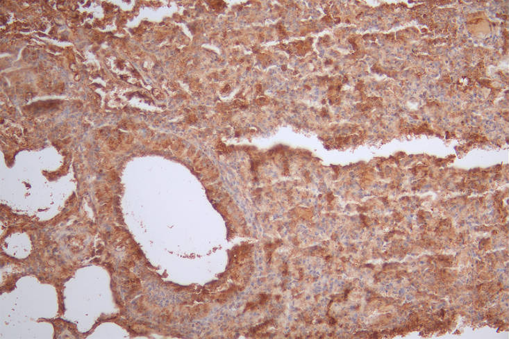 IHC image of RAC07175 diluted at 1:50 and staining in paraffin-embedded mouse lung tissue performed on a Leica BondTM system. After dewaxing and hydration, antigen retrieval was mediated by high pressure in a citrate buffer (pH 6.0). Section was blocked with 10% normal goat serum 30min at RT. Then primary antibody (1% BSA) was incubated at 4Â°C overnight. The primary is detected by a Goat anti-rabbit polymer IgG labeled by HRP and visualized using 0.53% DAB.