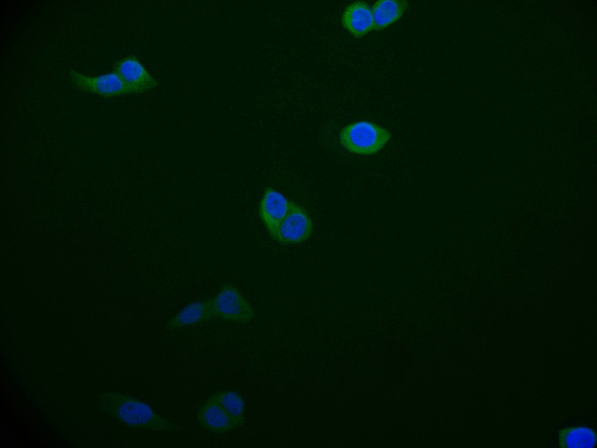 Immunofluorescence staining of A549 cell with RAC07176 at 1:50, counter-stained with DAPI. The cells were fixed in 4% formaldehyde and blocked in 10% normal Goat Serum. The cells were then incubated with the antibody overnight at 4Â°C. The secondary antibody was Alexa Fluor 526-congugated AffiniPure Goat Anti-Rabbit IgG(H+L).