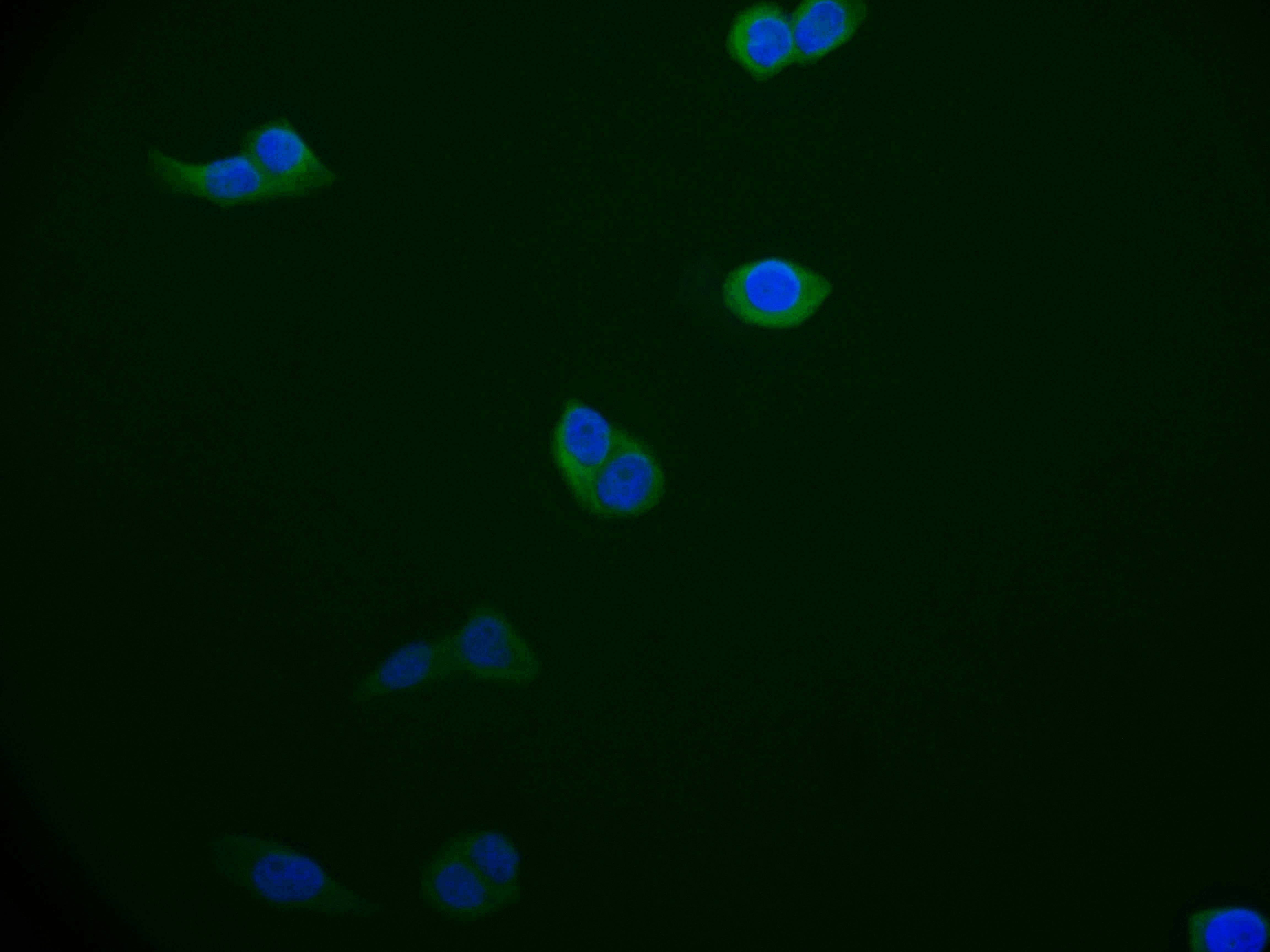 Immunofluorescence staining of A549 cell with RAC07176 at 1:50, counter-stained with DAPI. The cells were fixed in 4% formaldehyde and blocked in 10% normal Goat Serum. The cells were then incubated with the antibody overnight at 4Â°C. The secondary antibody was Alexa Fluor 526-congugated AffiniPure Goat Anti-Rabbit IgG(H+L).