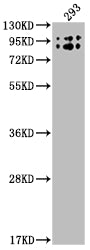 Western Blot; Positive WB detected in: 293 whole cell lysate; All lanes: BCHE antibody at 1:2000; Secondary; Goat polyclonal to rabbit IgG at 1/50000 dilution; Predicted band size: 69 kDa; Observed band size: 90 kDa