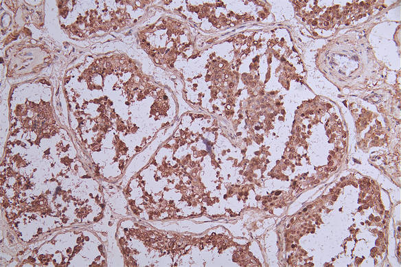 IHC image of RAC07178 diluted at 1:33 and staining in paraffin-embedded human testis tissue performed on a Leica BondTM system. After dewaxing and hydration, antigen retrieval was mediated by high pressure in a citrate buffer (pH 6.0). Section was blocked with 10% normal goat serum 30min at RT. Then primary antibody (1% BSA) was incubated at 4Â°C overnight. The primary is detected by a Goat anti-rabbit polymer IgG labeled by HRP and visualized using 0.73% DAB.