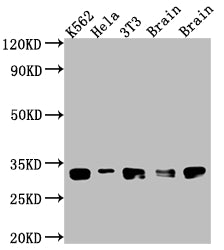 Western Blot; Positive WB detected in: K562 whole cell lysate, Hela whole cell lysate, NIH/3T3 whole cell lysate, Rat Brain whole cell lysate, Mouse Brain whole cell lysate; All lanes: Bcl-XL antibody at 1:1000; Secondary; Goat polyclonal to rabbit IgG at 1/50000 dilution; Predicted band size: 27, 19, 26 kDa; Observed band size: 30 kDa