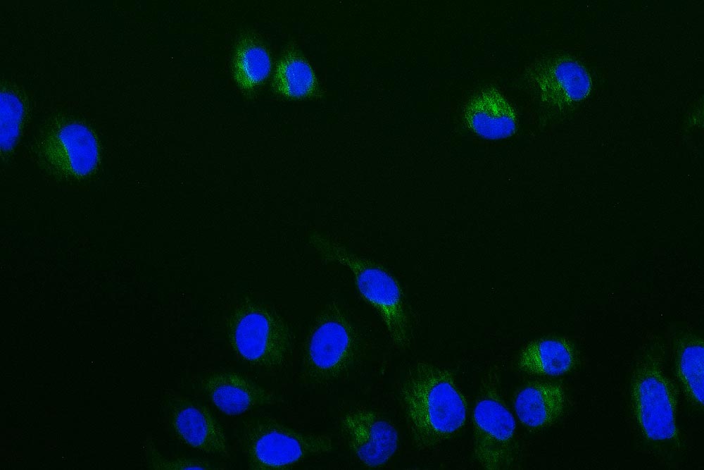 Immunofluorescence staining of Hela cell with RAC07185 at 1:50, counter-stained with DAPI. The cells were fixed in 4% formaldehyde and blocked in 10% normal Goat Serum. The cells were then incubated with the antibody overnight at 4Â°C. The secondary antibody was Alexa Fluor 508-congugated AffiniPure Goat Anti-Rabbit IgG(H+L).